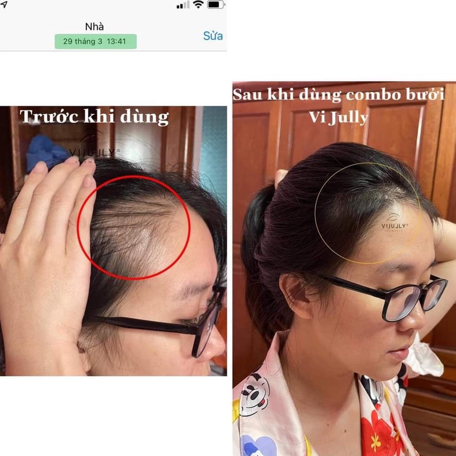 Xịt Dưỡng Tóc Tinh Dầu Bưởi VI JULLY COSMETIC Giảm Rụng, Mọc Tóc Nhanh | BigBuy360 - bigbuy360.vn