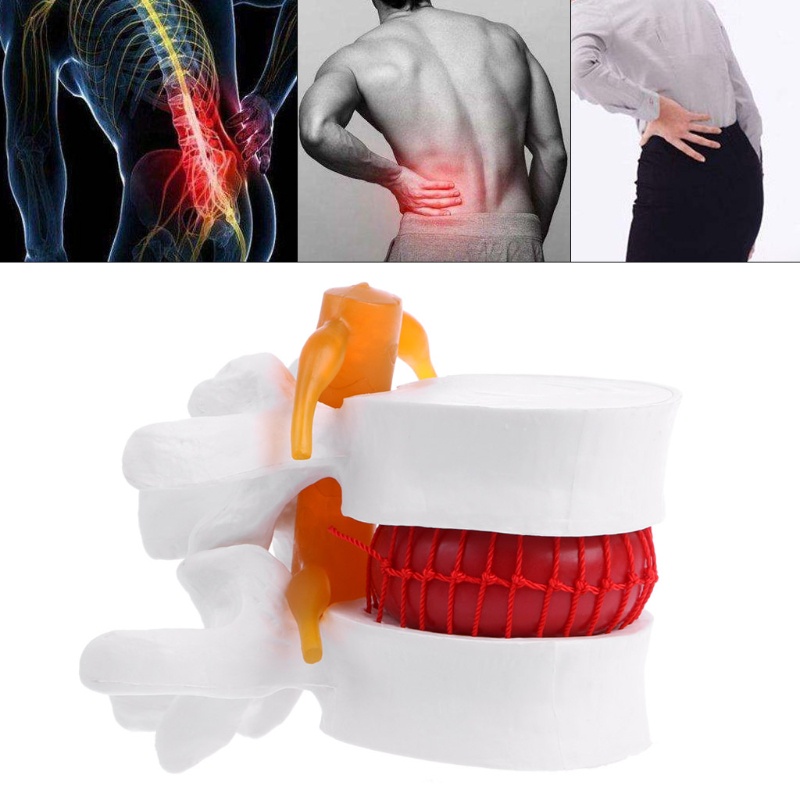 Mô Hình Giải Phẫu Giải Phẫu Học Y Tế Xương Người