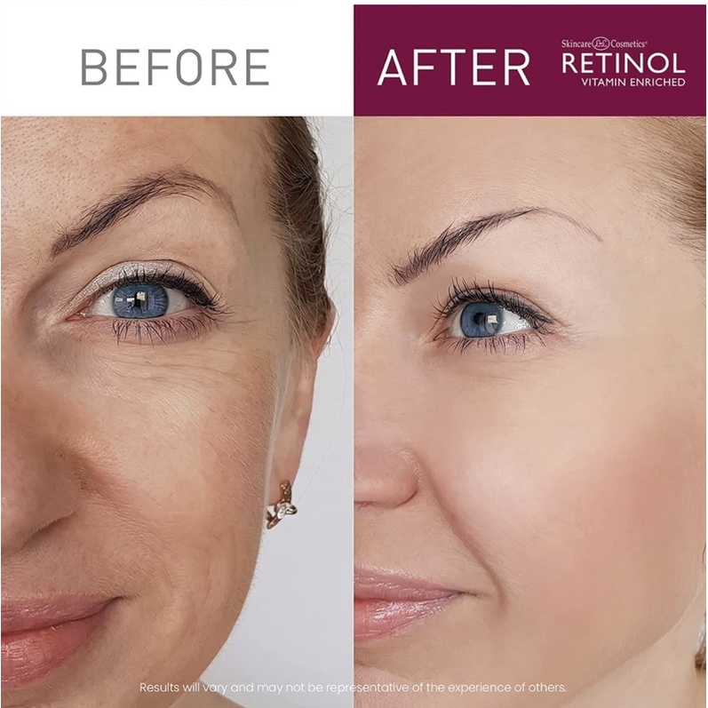 Bộ đôi chăm sóc da 24 GIỜ của bạn ngày & đêm Retinol Anti-Aging, Vitamin Enriched Night Cream & Day Cream 30ml/1 lọ