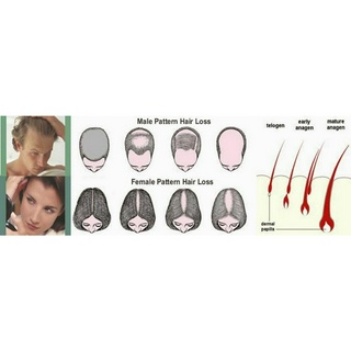 Thuốc xịt mọc tóc minoxidil 2%