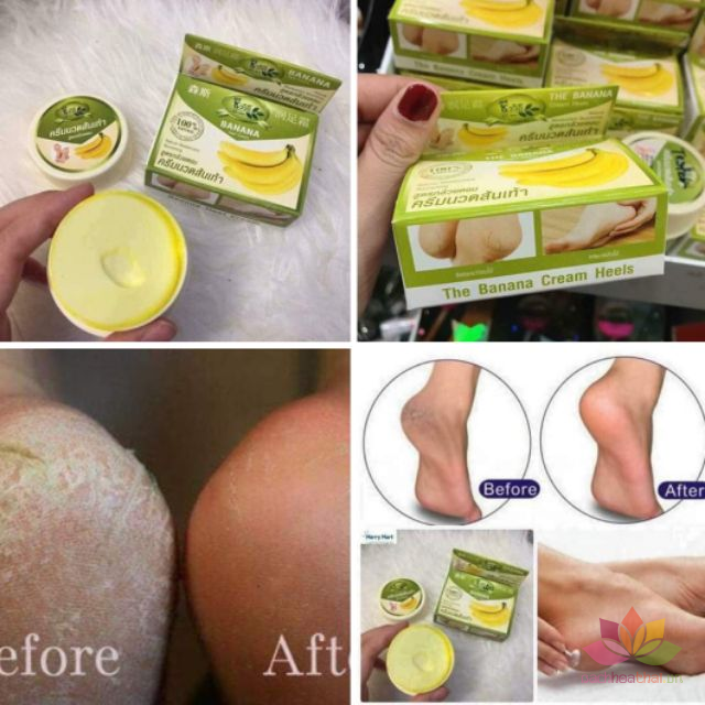 Kem ṫrị nứt gót châŋ Banana Heel Cream - Thailand