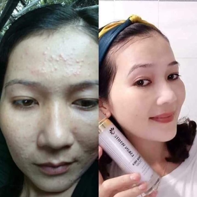 [SỈ SỐC] Compo 13 hộp Ủ Trắng kén tằm HOT NHẤT THỊ TRƯỜNG | BigBuy360 - bigbuy360.vn