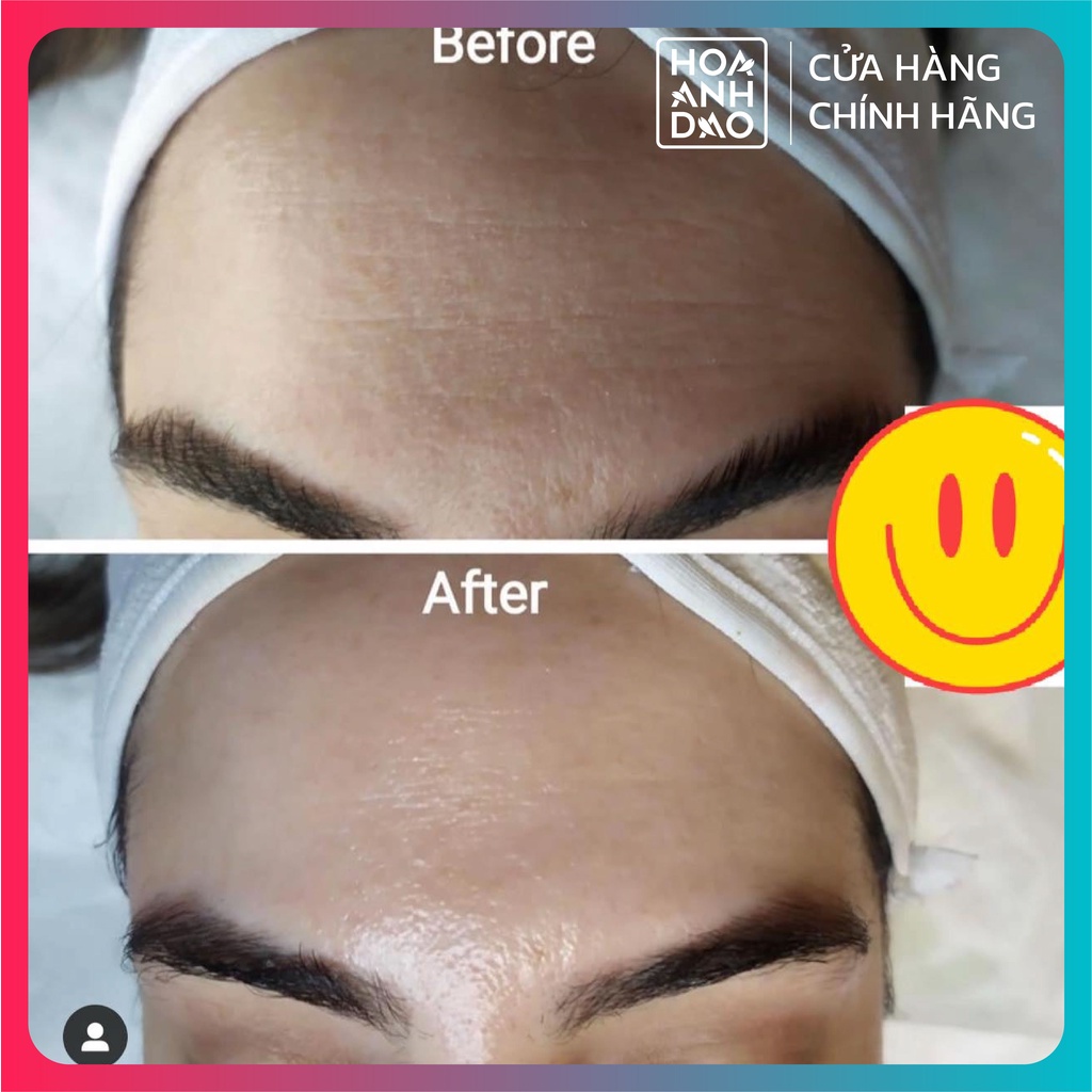 Serum dưỡng ẩm và chống lão hóa Mesoestetic HA Densimatrix 30ml