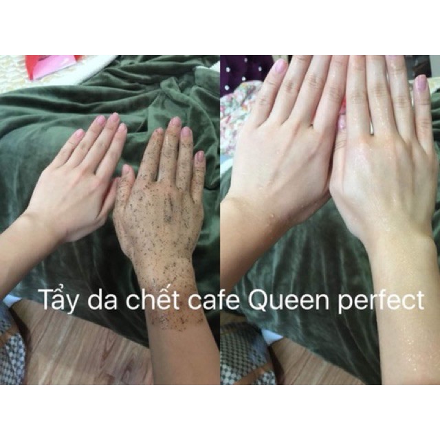 Tẩy da chết Queen Perfect