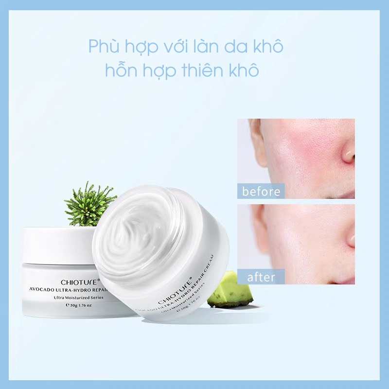 Kem dưỡng ẩm phục hồi da Chioture dành cho da khô 50ml