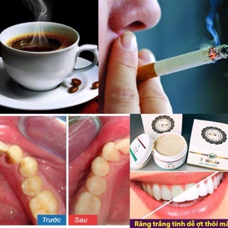 Bột trắng răng Twhite
