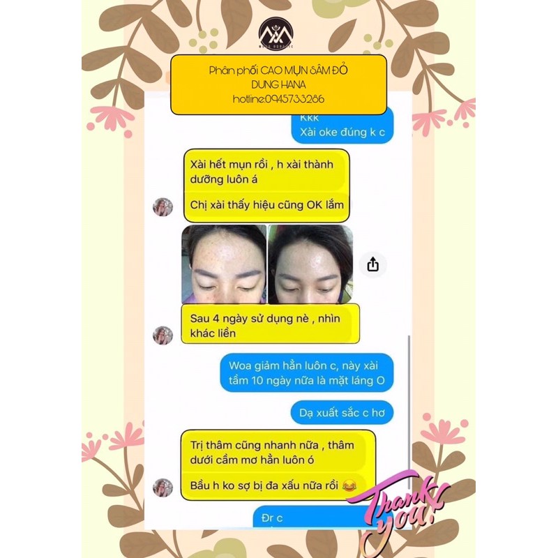 [Mã SKAMSALE8 giảm 10% đơn 200K] [CHÍNH HÃNG ]CAO MỤN SÂM ĐỎ -36vị thuốc quý | BigBuy360 - bigbuy360.vn