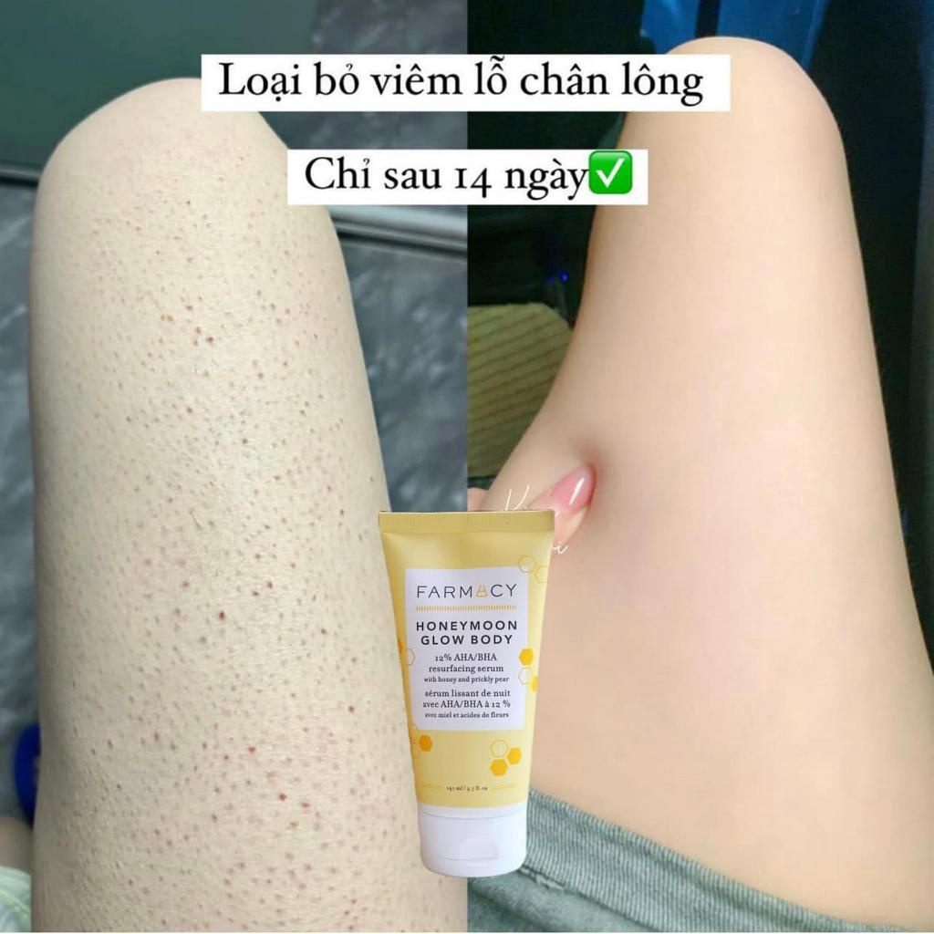 Serum dưỡng da body Farmacy Honeymoon làm sạch sâu chứa AHA/BHA
