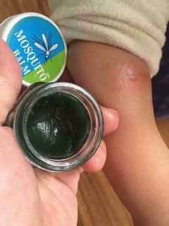 Dầu thoa trị muỗi đốt