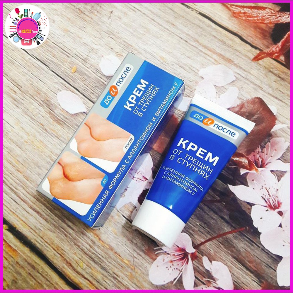 Kem Trị Nứt Gót Chân KPEM Dưỡng Ẩm và Làm Mềm 50ml NGA | BigBuy360 - bigbuy360.vn