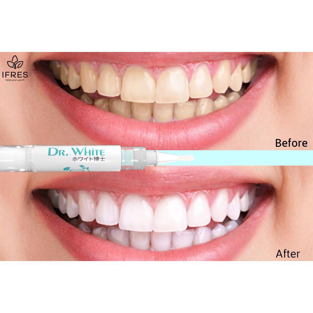 Gel trắng răng DR White, Gel làm trắng răng an toàn hiệu quả