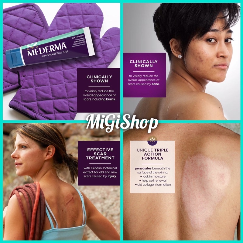 Gel Làm Mờ Sẹo Mederma Advanced Scar Gel Skin Protectant