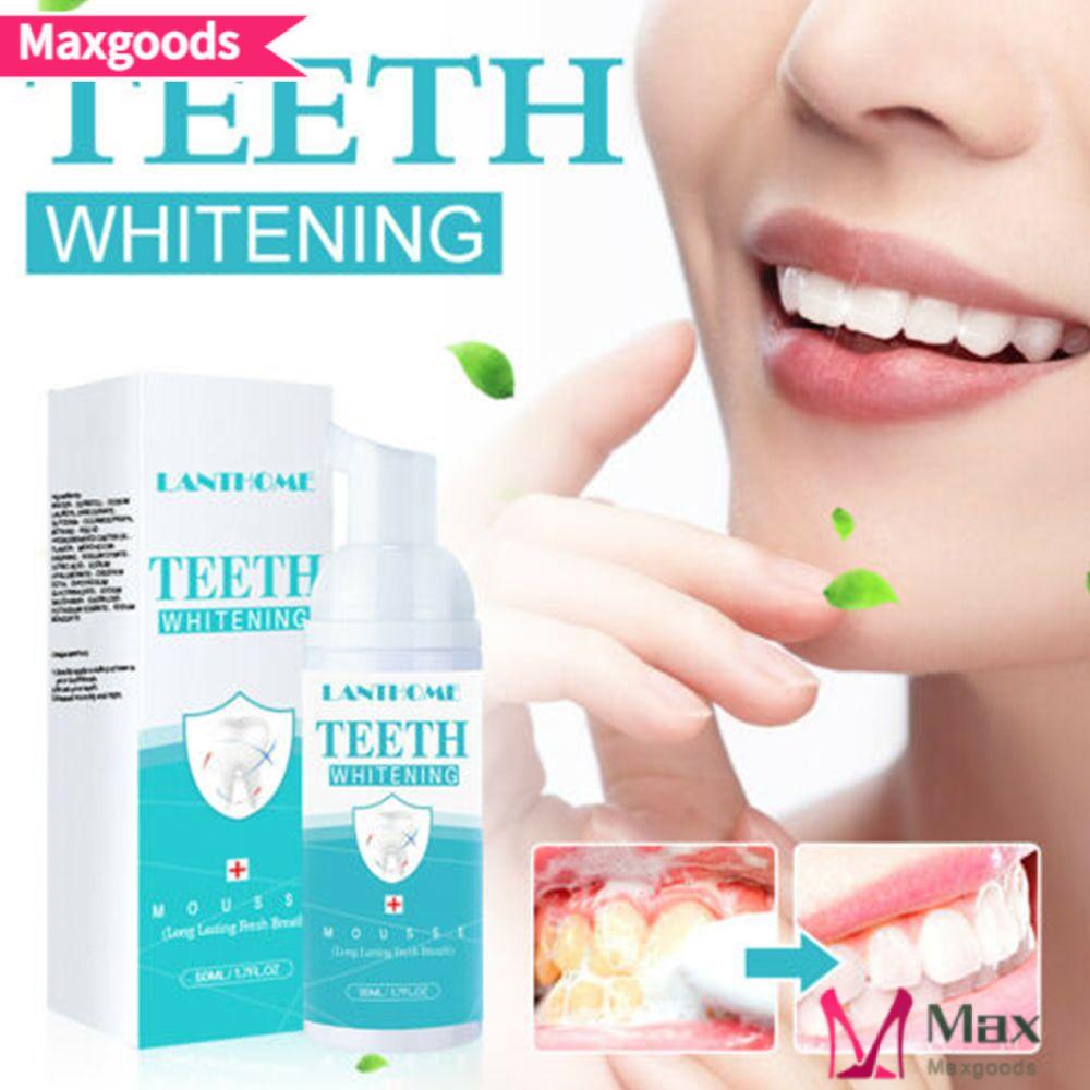 Kem Đánh Răng Làm Trắng Loại Bỏ Vết Bẩn Thoáng Khí