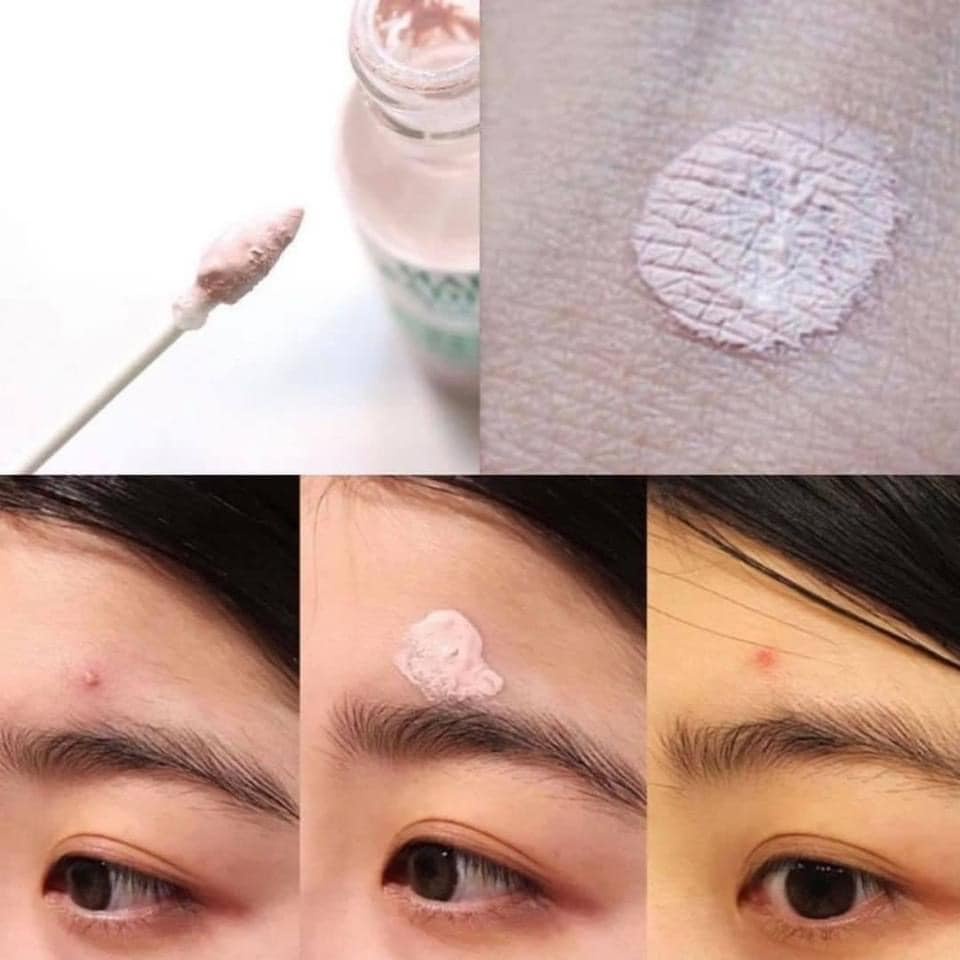 Chấm Mụn Mario Badescu Drying Lotion