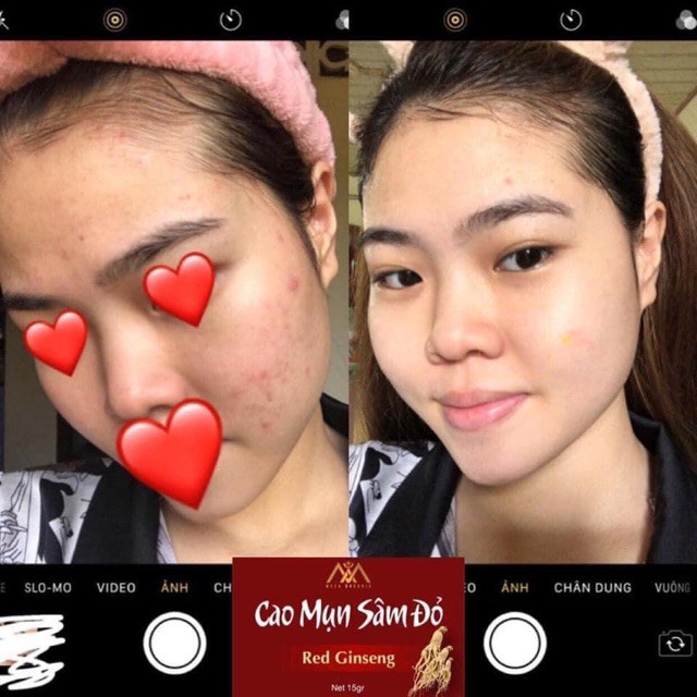 Cao mụn sâm đỏ MEEA ORGANIC mini size 5g