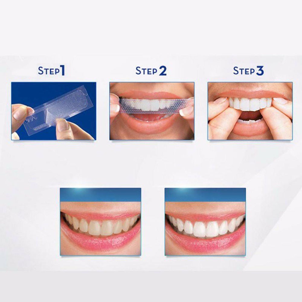 Miếng Dán Trắng Răng 3D White Teeth Whitening Strips - Sarah Beaute MP35