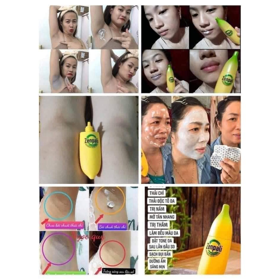Chuối Cấy Trắng Thải Chì Zenpali Giảm Thâm Mụn, Mông, Nách, Bẹn Whitening Detox Cream ONVAON | BigBuy360 - bigbuy360.vn