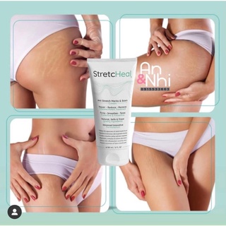 Kem rạn da Stretcheal