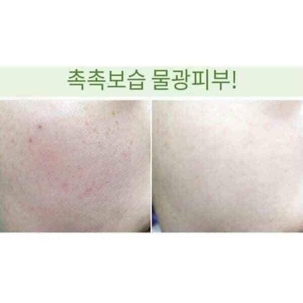 Tinh chất rau má DR.AG+ Cica hyaluronic calming Ampule