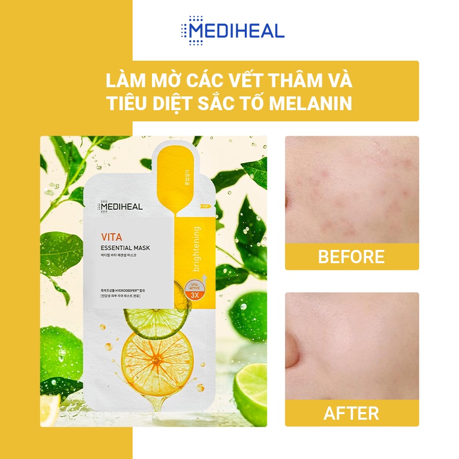 Mặt Nạ Dưỡng Da Trắng Sáng, Mờ Thâm Cho Da Mụn Mediheal Vita Brightening Essential Mask 24ml