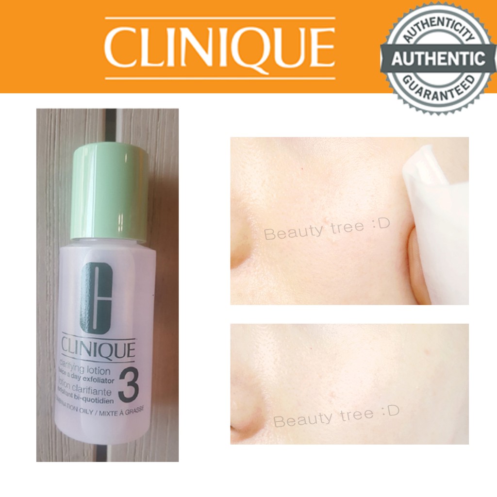 Clinique Toner Cấp Ẩm Số 3 Clarifying Lotion Da Hỗn Hợp Dầu 150ml(30mlx5pcs)