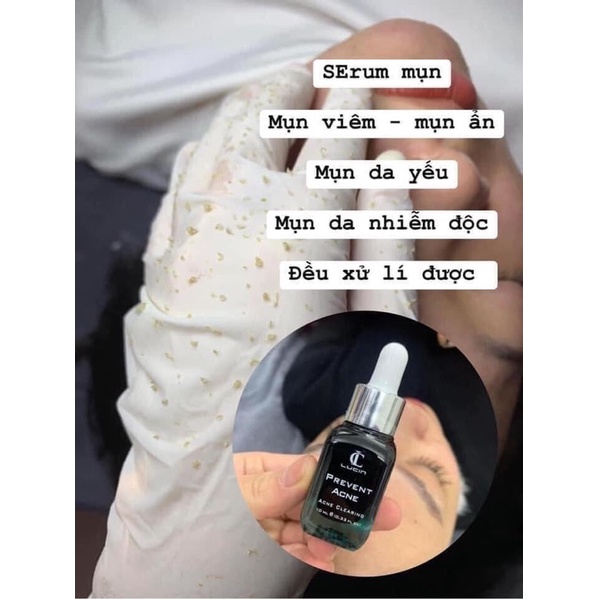 Serum Chăm Sóc Da Mụn, Mờ Thâm LURCINN Prevent Acne 10ml