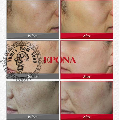 Kem Dưỡng Dầu Ngựa Epona All In One Total Skin Care Intensive