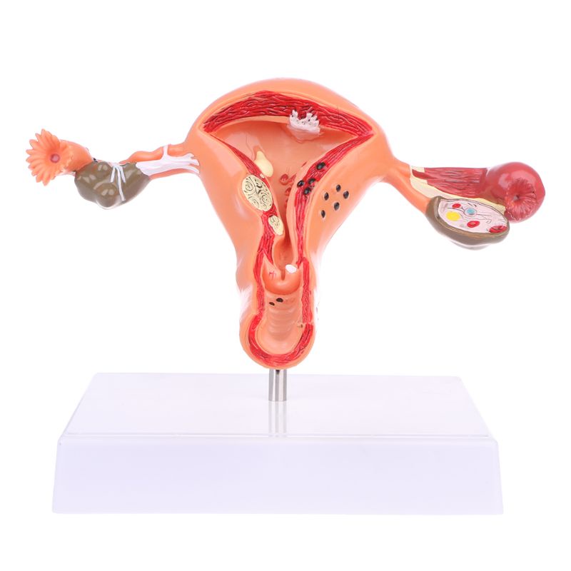 Wer Mô Hình Giải Phẫu Uterus Ovary Cho Học Sinh