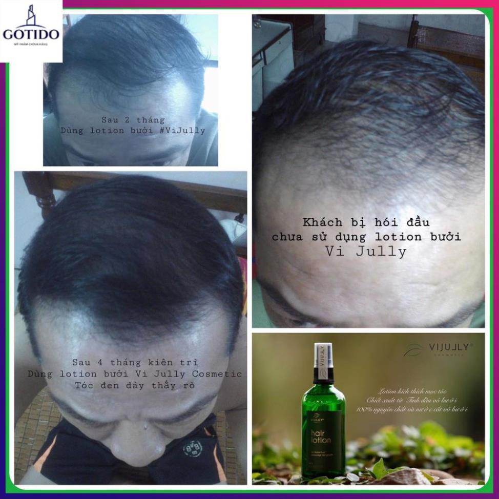 ComBo Bộ 3 Dầu Gội Trị Rụng Tóc + Dầu Xả Bưởi và Tinh dầu bưởi Vi Jully Cao Cấp | BigBuy360 - bigbuy360.vn