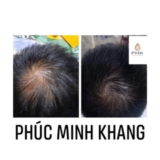 Tinh chất mọc tóc Cao Cấp Phúc Minh Khang