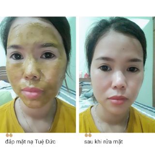 Thảo dược đắp mặt Tuệ Đức( xem ảnh thật khách dùng phía sau)
