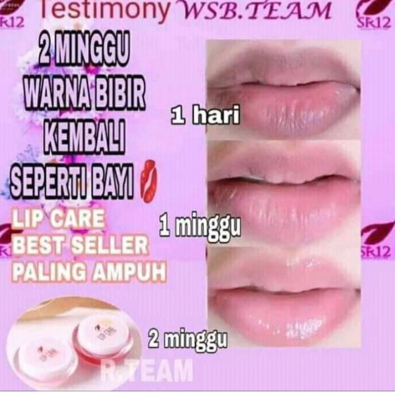 (Hàng Mới Về) Gel Dưỡng Môi Tr 17ap6bh Sr12 Màu Sắc | BigBuy360 - bigbuy360.vn