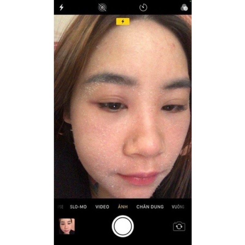 Tinh chất tái tạo da -Không sưng k đỏ chai 20 ml handmade