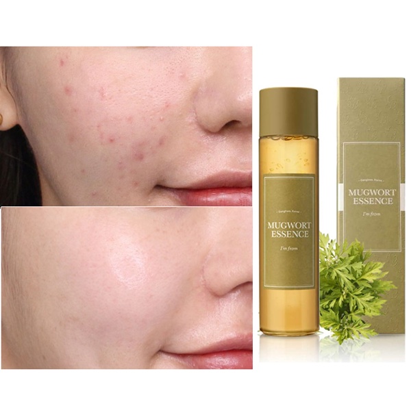 Tinh Chất Ngải Cứu I'm From Mugwort Essence 160ml