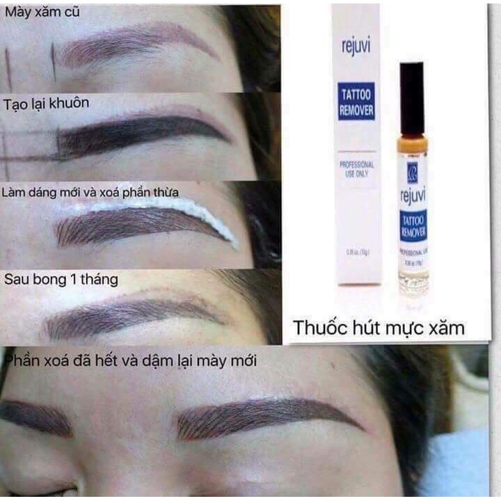 Dung dịch xóa Rejuvi