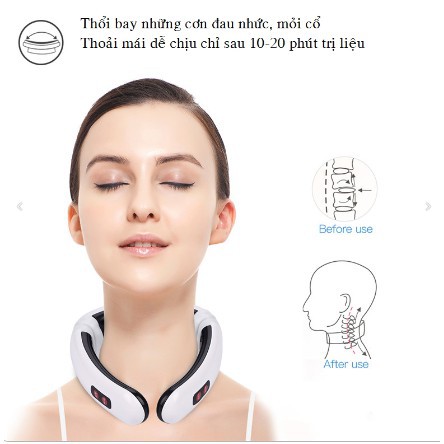 MÁY TRỊ LIỆU MASSAGE CỔ 3D