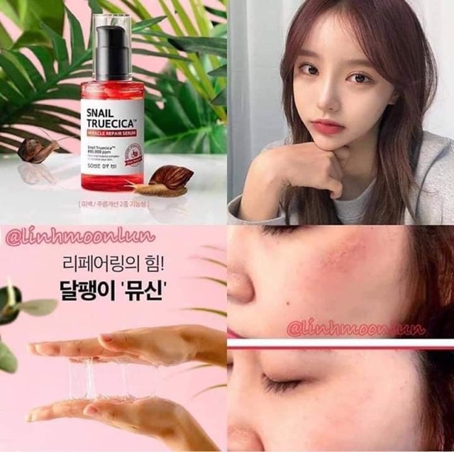 ( Sẵn ) Tinh chất sẹo mụn ốc sên SOME BY MI SNAIL TRUECICA MIRACLE REPAIR SERUM | BigBuy360 - bigbuy360.vn