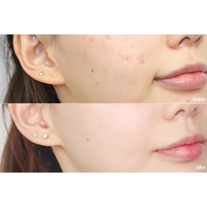 Toner The Ordinary glycolic acid 7% 240ml Toning Solution | BigBuy360 - bigbuy360.vn