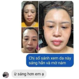 [ Hàng Chuẩn Cty ] Serum 7 Day Olic 10ml