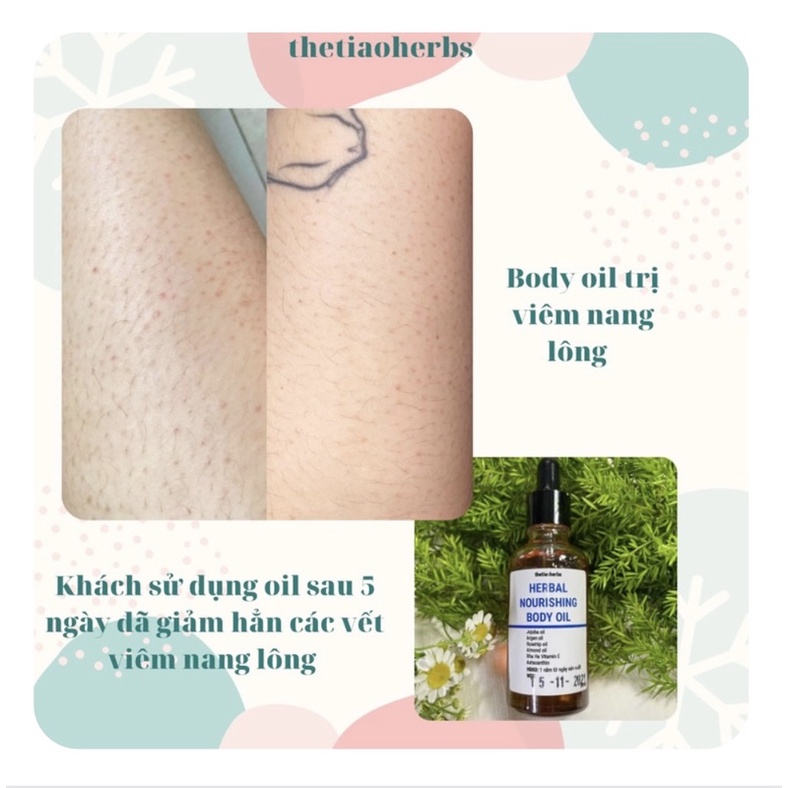 Dầu dưỡng da từ thảo mộc thiên nhiên Herbal Nourishing Body Oil Thetiaoherbs