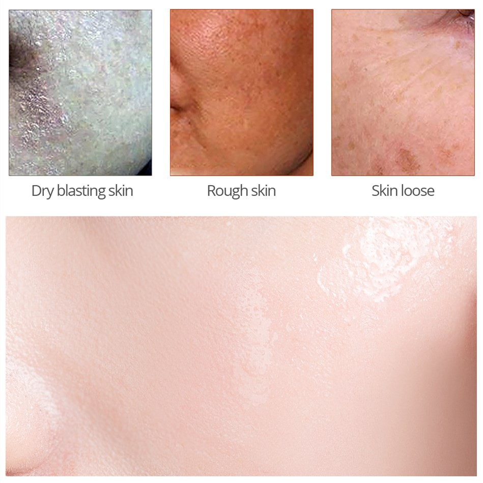 Tinh Chất GDTIMA Chứa Hyaluronic Acid Dưỡng Ẩm 30ml