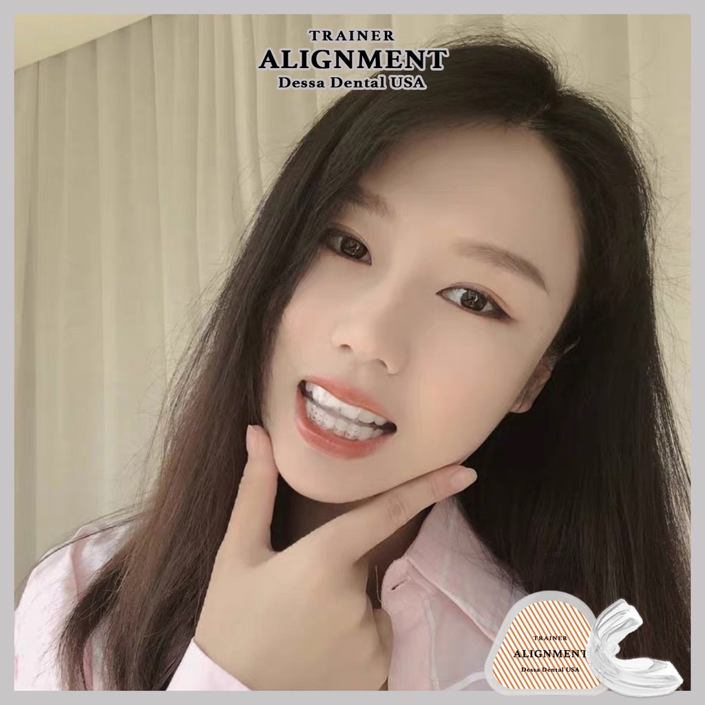 Niềng Răng Silicon Tại Nhà An Toàn Hiệu Quả Cho Người Lớn trên 16 tuổi
