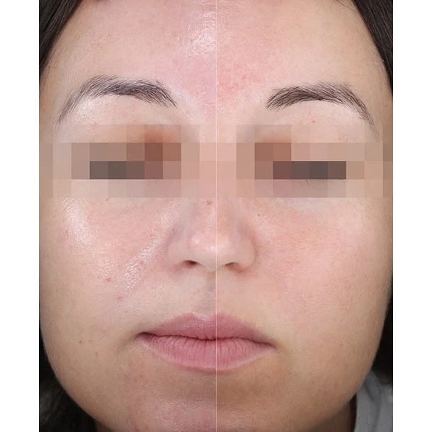 Kem Chống Nắng Eucerin Sun Gel-Creme Oil Control Dry Touch SPF 50 - 50ml