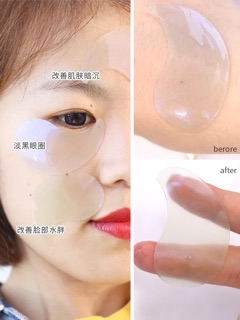 Mặt nạ mắt JM SOLUTION EYE PATCH