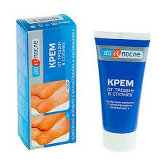 Kem trị nứt gót chân Kpem 50ml