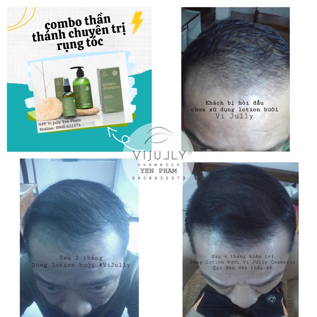 [Chính hãng] Tinh dầu bưởi VIJULLY - mọc tóc siêu đỉnh, giảm rụng hiệu quả - thiên nhiên, nguyên chất 100%, dưỡng tóc | BigBuy360 - bigbuy360.vn