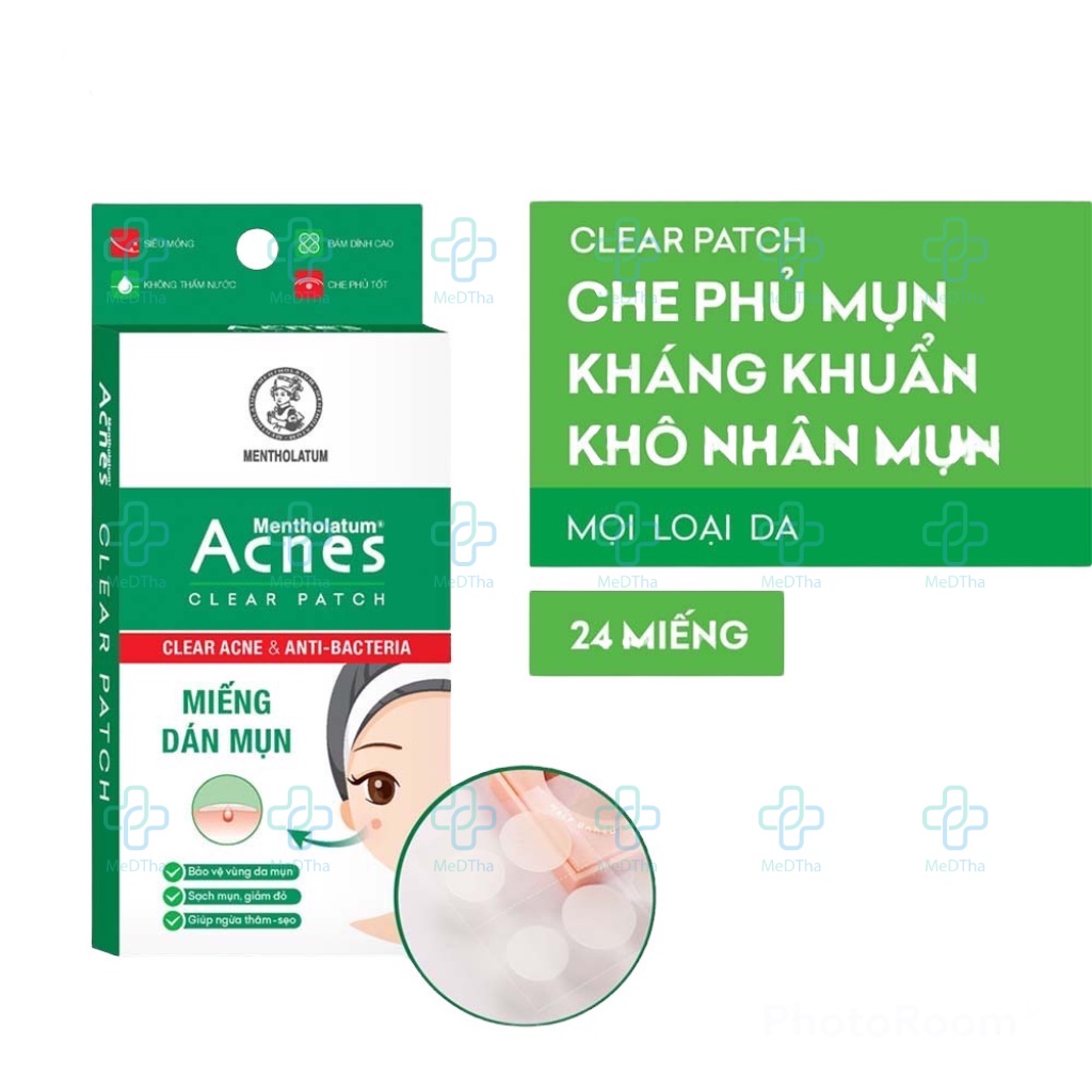 Miếng Dán Mụn Acnes - Dán Mụn, Thấm Dầu, Thâm Sẹo, Ngừa Mụn (Hộp 24 Miếng) [Chính Hãng]