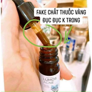 Serum mụn Lumos Ance Hàng chuẩn check Code, date mới