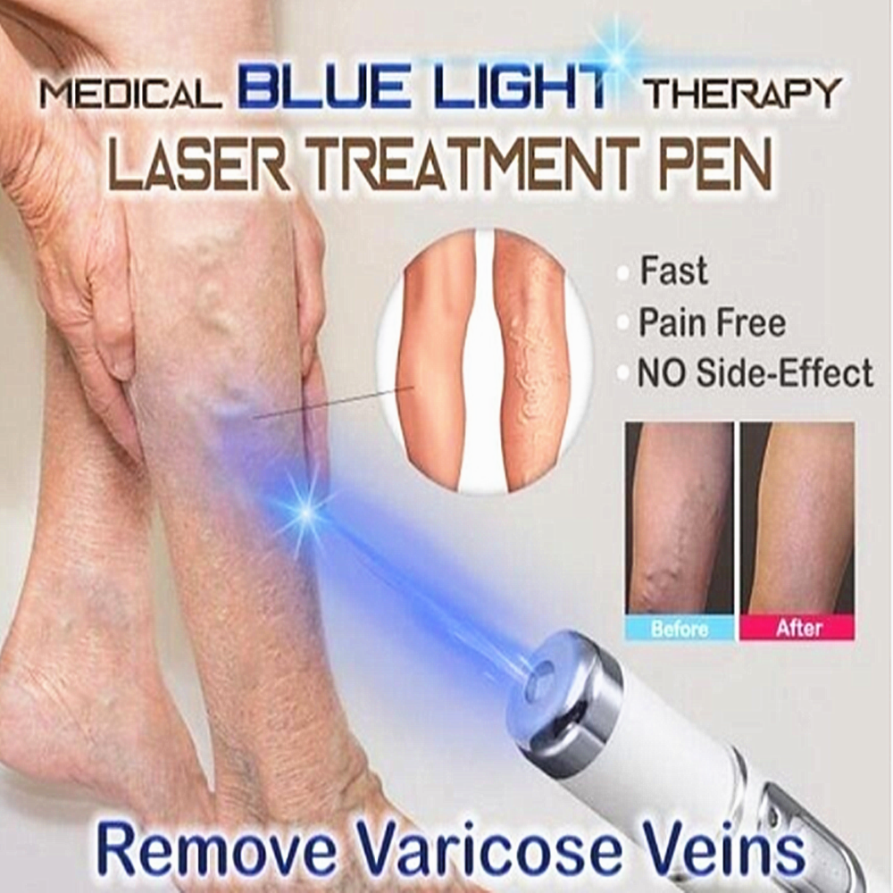 Bút laser ánh sáng xanh hỗ trợ giảm sẹo mụn ngăn ngừa nếp nhăn hiệu quả