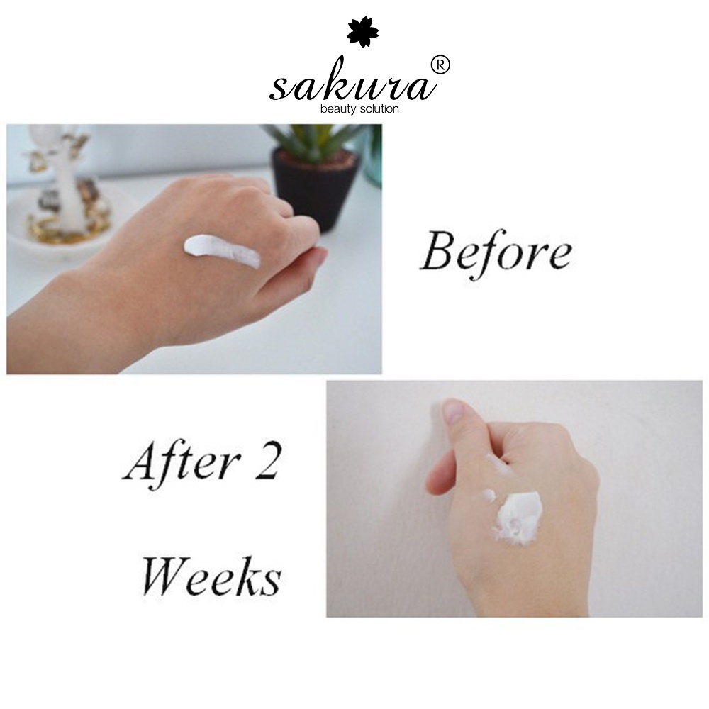 [Mã INCU20 giảm 20K đơn 150K] Kem dưỡng da trắng sáng Sakura Spots Care Brightening Cream mờ nám sạm 10g